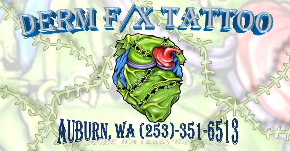 Tattoo Removal in Tacoma WA
